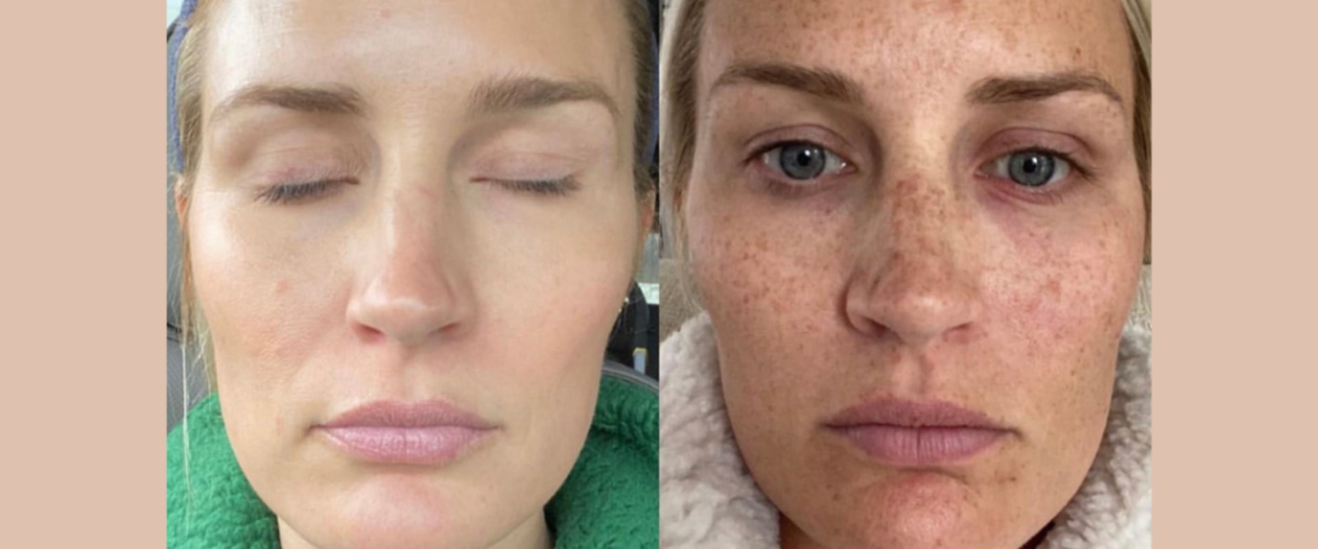 Before and After Photos of Previous Patients: The Ultimate Guide to Finding a Reputable Cosmetic Clinic in the UK