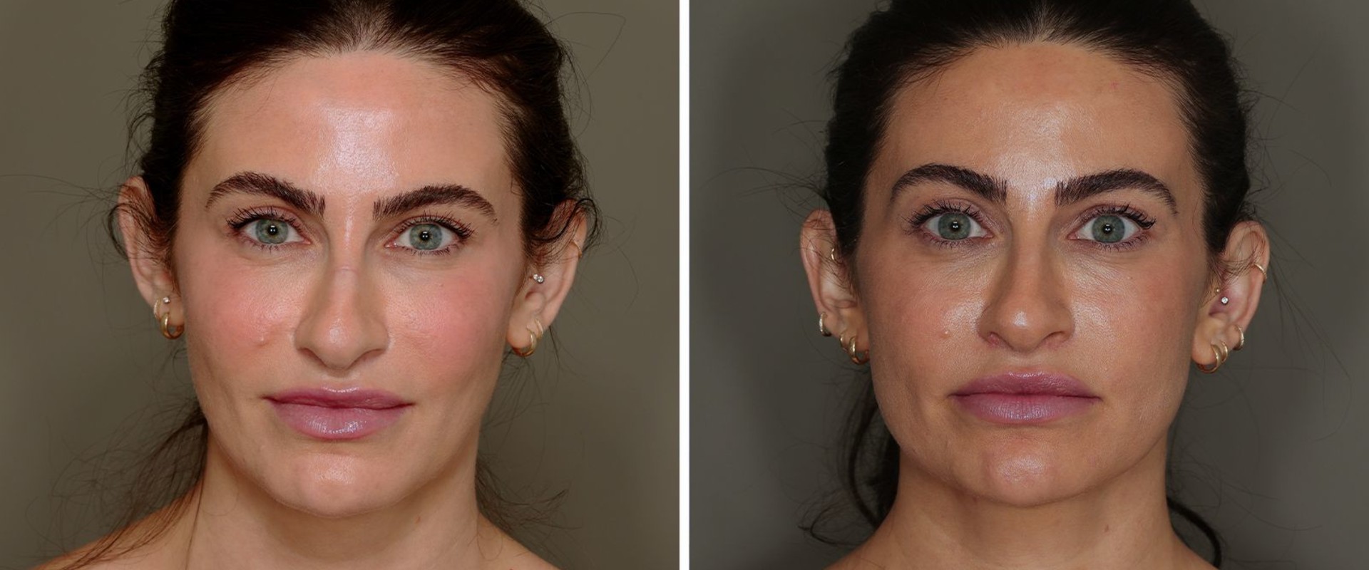 The Positive Impact of Cosmetic Enhancements on First Impressions