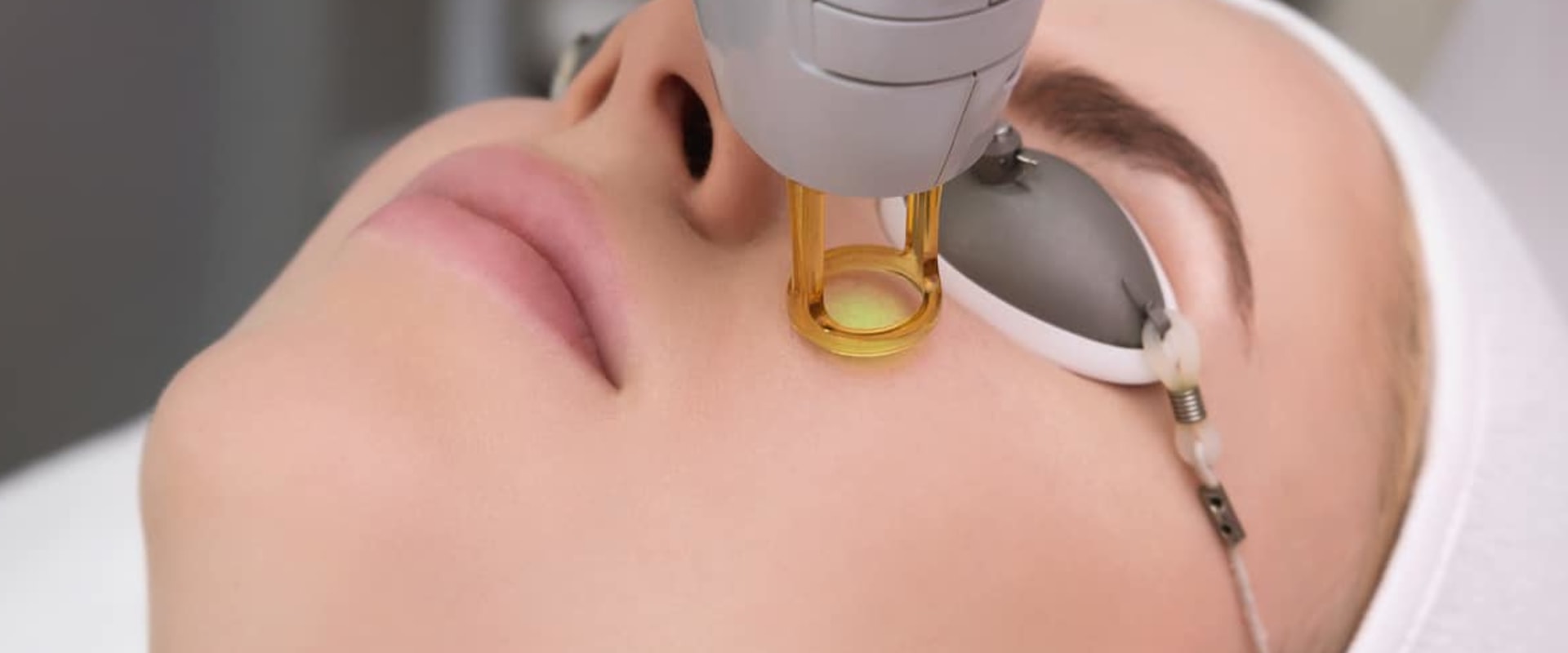IPL Photofacial - A Popular Skin Rejuvenation Treatment in the UK