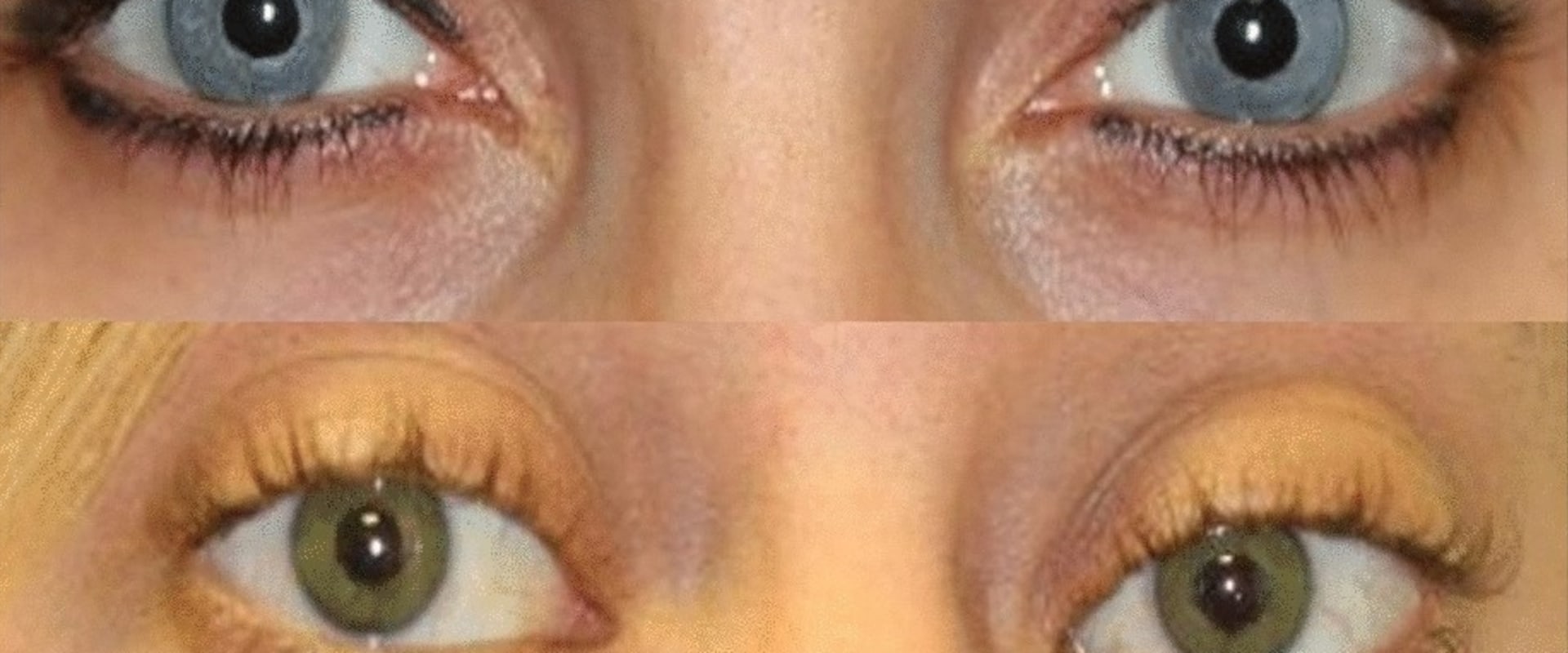 The Truth About Surgical vs Non-Surgical Options for Permanent Alteration of Appearance