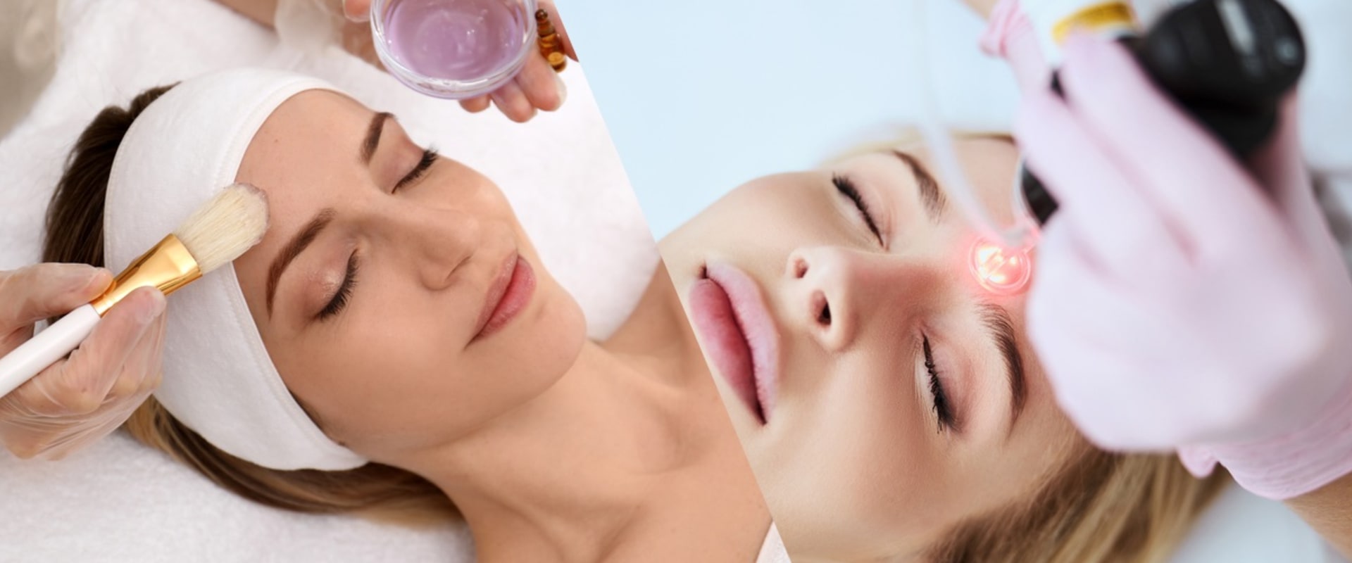 A Comprehensive Look at Chemical Peels for Aesthetic Treatments