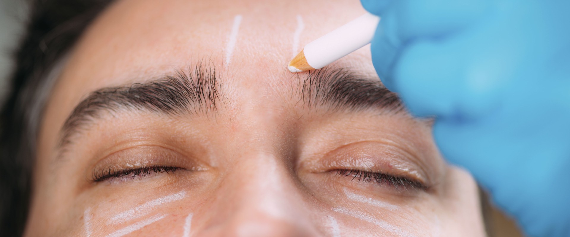 How to Choose Between Surgical and Non-Surgical Options for Cosmetic Procedures