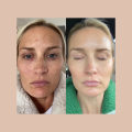 Before and After Photos of Previous Patients: The Ultimate Guide to Finding a Reputable Cosmetic Clinic in the UK