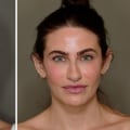 The Positive Impact of Cosmetic Enhancements on First Impressions