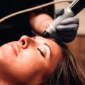 The Basics of Microneedling: A Comprehensive Guide to Popular Facial Treatments