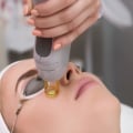 IPL Photofacial - A Popular Skin Rejuvenation Treatment in the UK