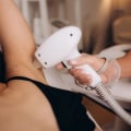 The Power of Laser Hair Removal: Achieving Smooth Skin with Top Aesthetic Clinics in the UK