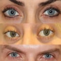 The Truth About Surgical vs Non-Surgical Options for Permanent Alteration of Appearance