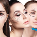 Enhance Your Look: A Guide to Cosmetic Clinics and Procedures in the UK