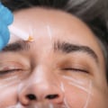 How to Choose Between Surgical and Non-Surgical Options for Cosmetic Procedures