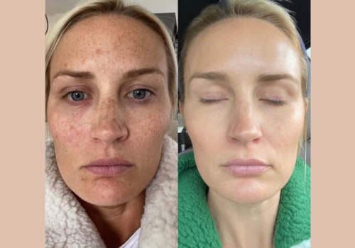 Before and After Photos of Previous Patients: The Ultimate Guide to Finding a Reputable Cosmetic Clinic in the UK