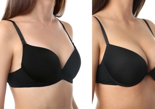 A Comprehensive Look at Breast Augmentation