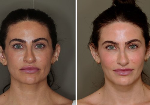 The Positive Impact of Cosmetic Enhancements on First Impressions