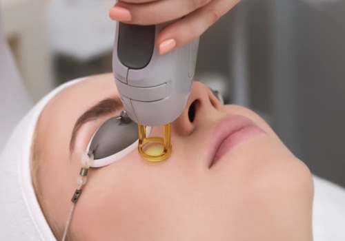 IPL Photofacial - A Popular Skin Rejuvenation Treatment in the UK