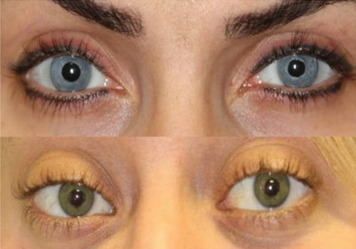 The Truth About Surgical vs Non-Surgical Options for Permanent Alteration of Appearance
