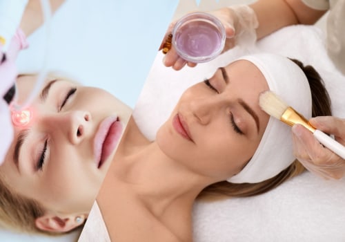 A Comprehensive Look at Chemical Peels for Aesthetic Treatments