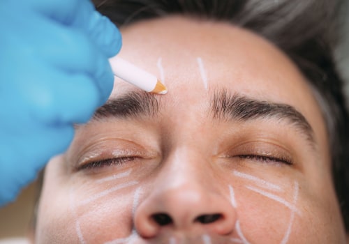 How to Choose Between Surgical and Non-Surgical Options for Cosmetic Procedures